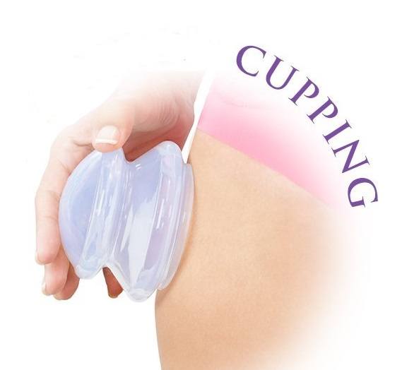 body-cupping